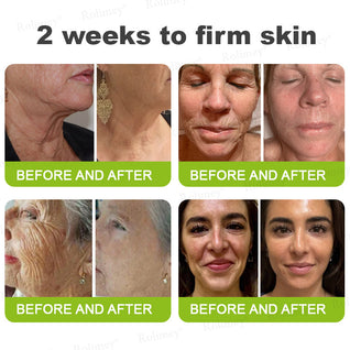 Evora Advanced Retinol Shot – Triple-Action Wrinkle Lift & Collagen Catalyst (Advanced 2026 Edition)