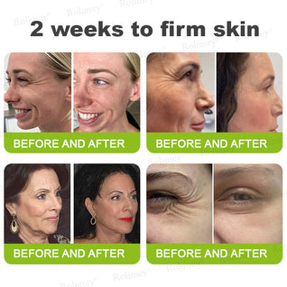Evora Advanced Retinol Shot – Triple-Action Wrinkle Lift & Collagen Catalyst (Advanced 2026 Edition)