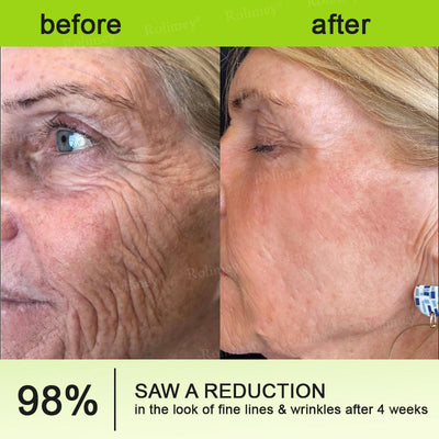 Evora's Rolimey® Botox & Vita-A Retinol Wrinkle-Lift Cream – Made & Shipped in the USA