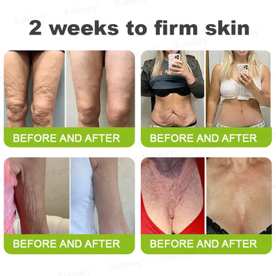 Evora's Rolimey® Botox & Vita-A Retinol Wrinkle-Lift Cream – Made & Shipped in the USA