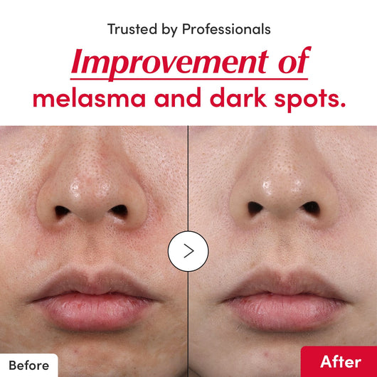 Evora Vitamin illuminating Serum