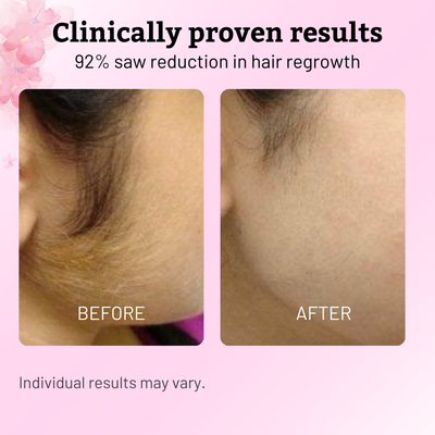 Cyperus Rotundus Botanical Serum — Softer Regrowth. Calmer Skin.
