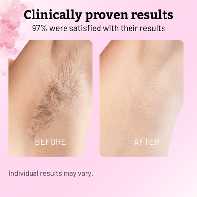 Cyperus Rotundus Botanical Serum — Softer Regrowth. Calmer Skin.