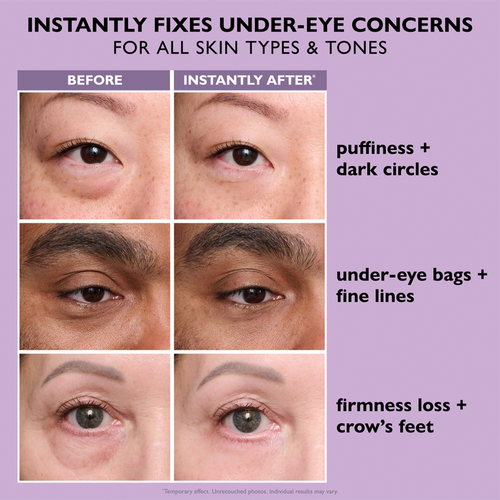 Instant Eye Tightening Cream