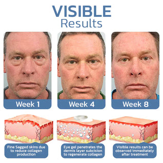 Evora™ Awaken Peptide Lifting Eye Gel