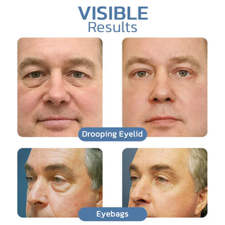 Evora™ Awaken Peptide Lifting Eye Gel