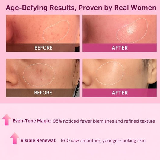 Evora™ – Collagen Jelly Face Cream (3.4 fl. oz / 100ml)