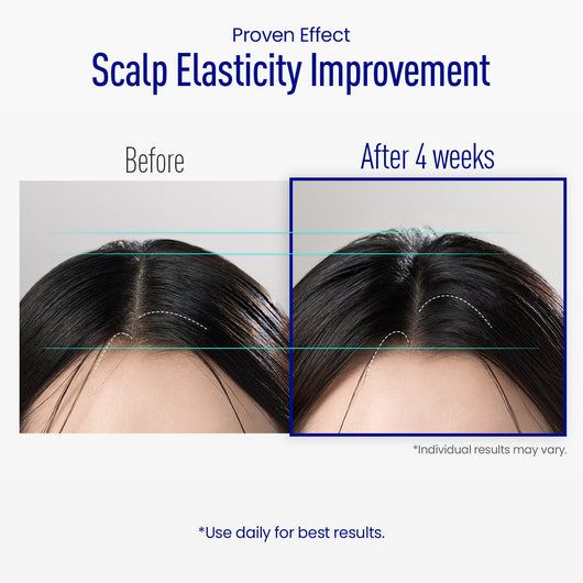 ViveLab Spioxyl™ Scalp Serum 400 – 220K Micro-Spicules for Thicker, Fuller Hair | Dermatologist-Recommended K-Beauty Scalp Serum (0.5 fl oz)