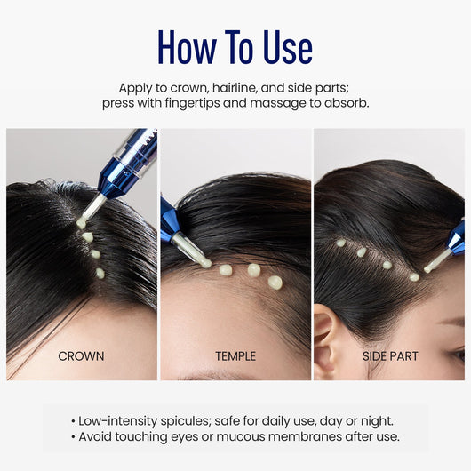 ViveLab Spioxyl™ Scalp Serum 400 – 220K Micro-Spicules for Thicker, Fuller Hair | Dermatologist-Recommended K-Beauty Scalp Serum (0.5 fl oz)