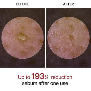 Glow Rice Ampoule Peel Shot